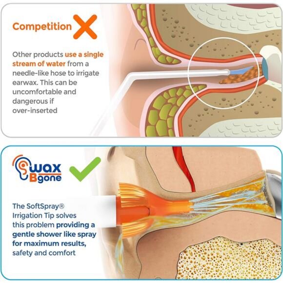 Earwax Removal Kit - Fast, Gentle, and Effective Ear Wax Removal Kit - Picture 6 of 7